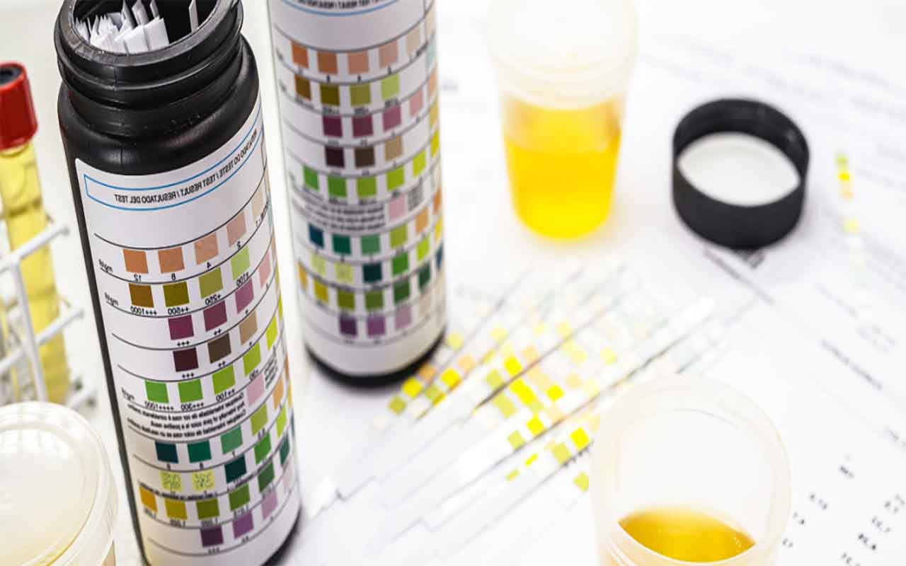 cetose-sans-test